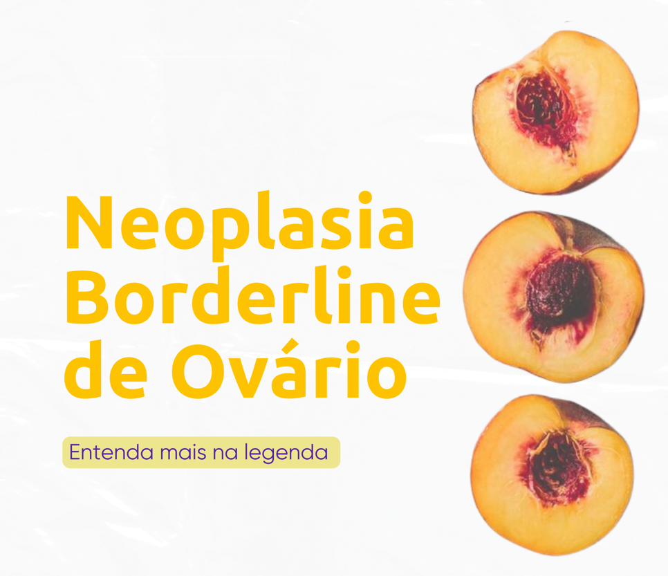 Neoplasia Borderline de Ovário